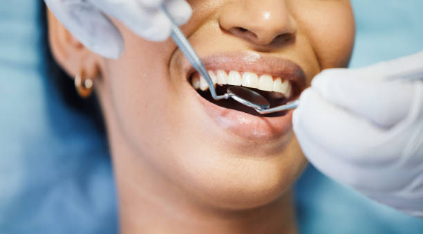 Best Emergency Treatment for Dental Infections or Abscesses in Rosedale, LA